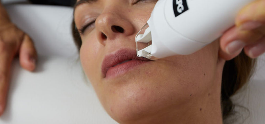 slider lpg gesichtsbehandlung